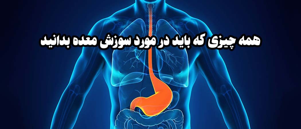 همه چیزی که باید در مورد سوزش معده و GERD بدانید